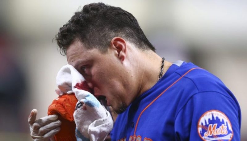 Wilmer Flores se rompió la nariz con un foul